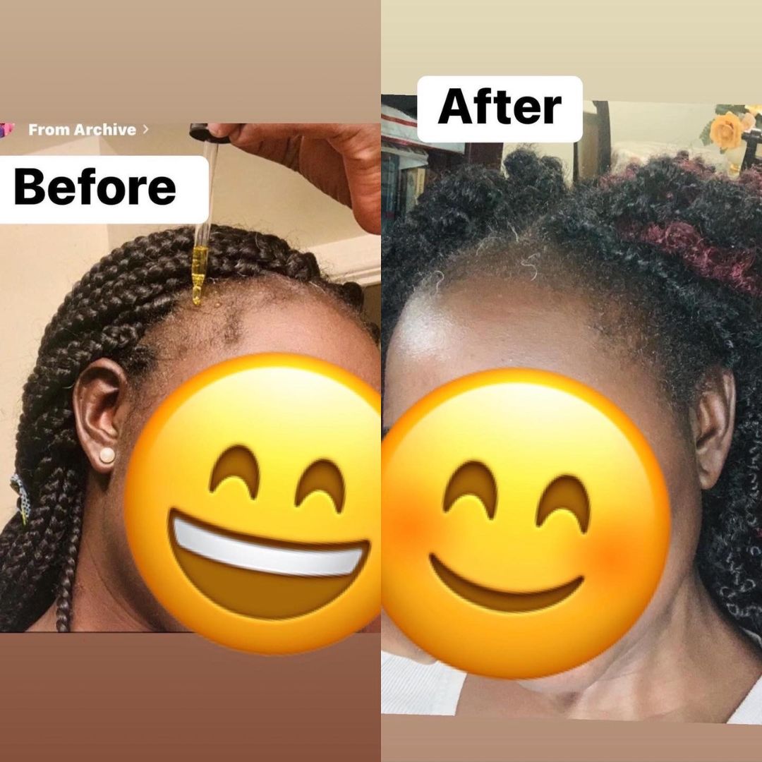 Hair Growth Oil and Butter Bundle