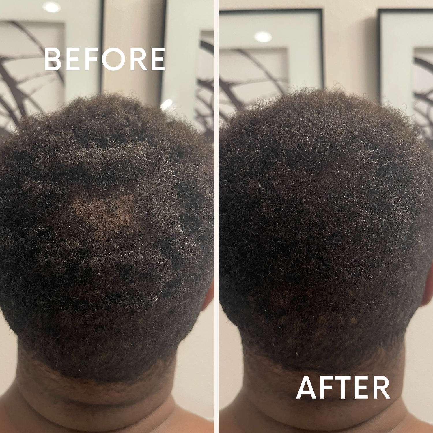 Wild Growth Hair Oil | Organic Hair Oil | Afolari