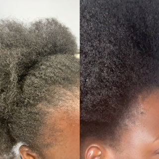 Hair Growth Oil | Hair Growth Butter | Afolari