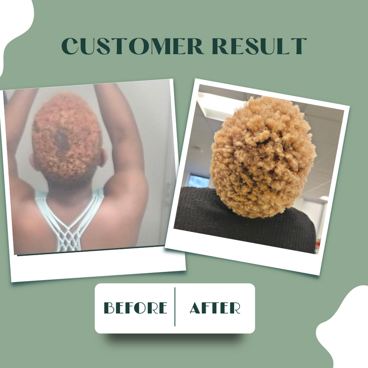 Hair Growth Oil and Butter Bundle | Afolari